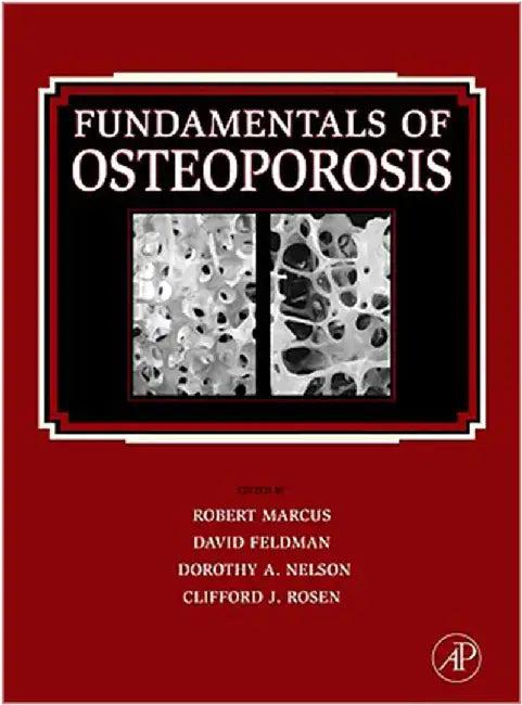 Fundamentals Of Osteoporosis (English, Robert Marcus)