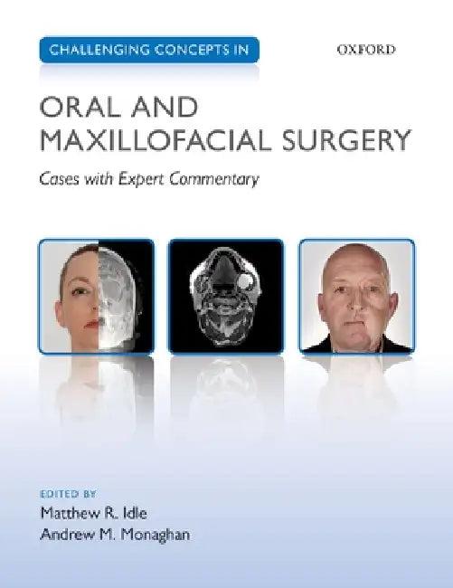 Challenging Concepts in Oral and Maxillofacial Surgery (English, Matthew Idle | Andrew Monaghan)