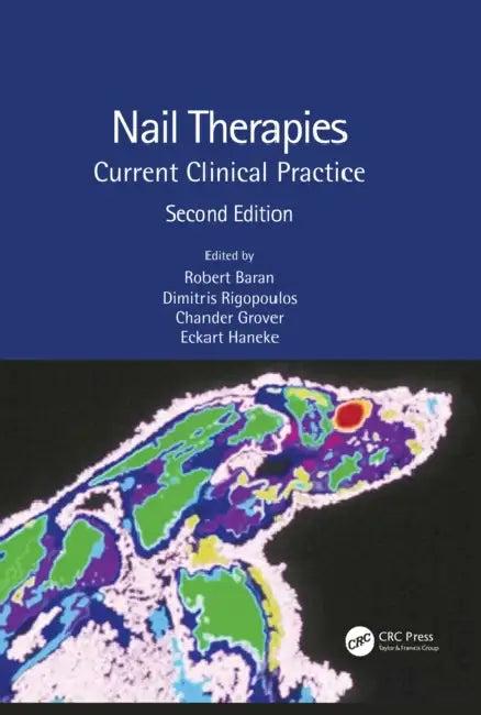 Nail Therapies (English, Baran Robert | Dimitris Rigopoulos | Chander Grover)