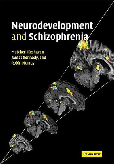 Neurodevelopment and Schizophrenia (English, Matcheri S. Keshavan | James L. Kennedy | Robin M. Murray)