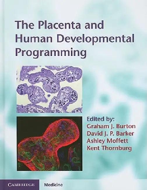 The Placenta and Human Developmental Programming (English, Graham J. Burton | David J. P. Barker | Ashley Moffett)