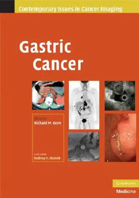 Gastric Cancer (English, Richard M. Gore)