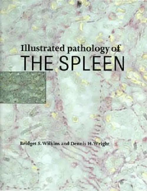 Illustrated Pathology of the Spleen (English, Bridget S. Wilkins | Dennis H. Wright)