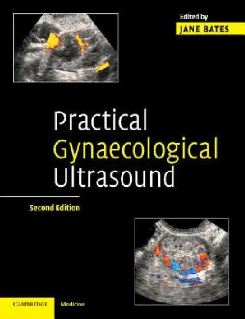Practical Gynaecological Ultrasound (English, Jane Bates)