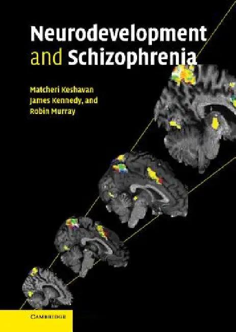 Neurodevelopment and Schizophrenia (English, Robin Murray | Matcheri Keshavan | James Kennedy)