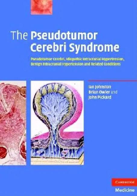 The Pseudotumor Cerebri Syndrome (English, Ian Johnston | Brian Owler | John Pickard)