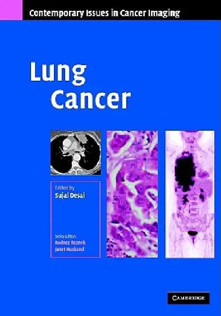 Lung Cancer (English, Sujal R. Desai)