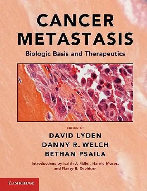 Cancer Metastasis (English, David Lyden | Danny R. Welch | Bethan Psaila)