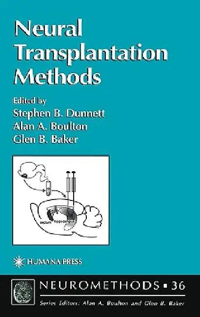 Neural Transplantation Methods (English, Stephen B. Dunnett | Alan A. Boulton | Glen B. Baker)