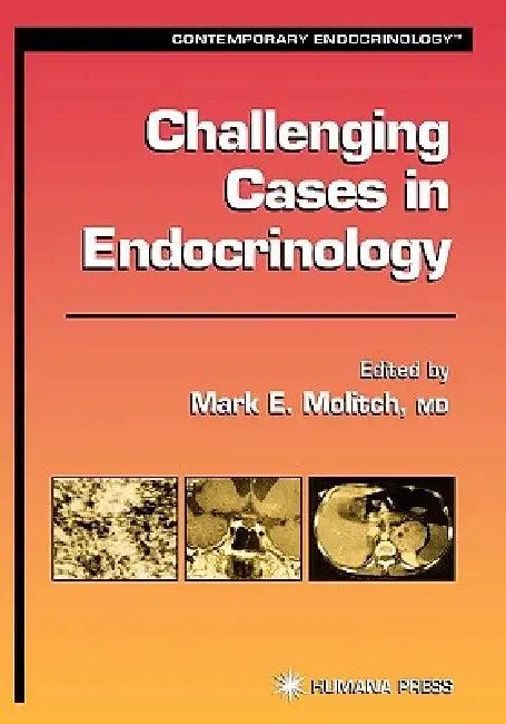 Challenging Cases in Endocrinology (English, Mark E. Molitch)