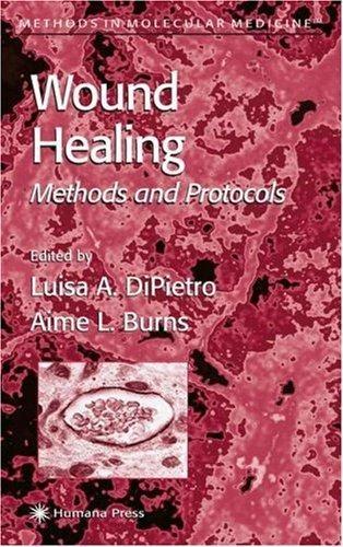 Wound Healing (English, Luisa A. DiPietro | Aime L. Burns)
