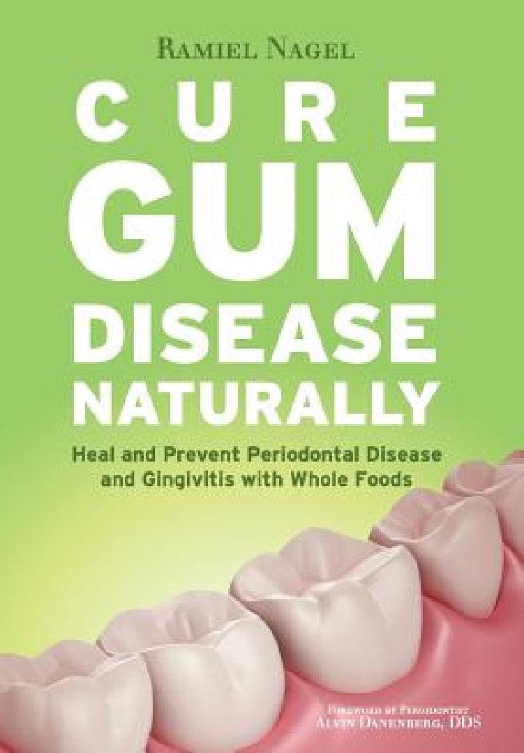 Cure Gum Disease Naturally (English, Ramiel Nagel | Alvin Danenberg)