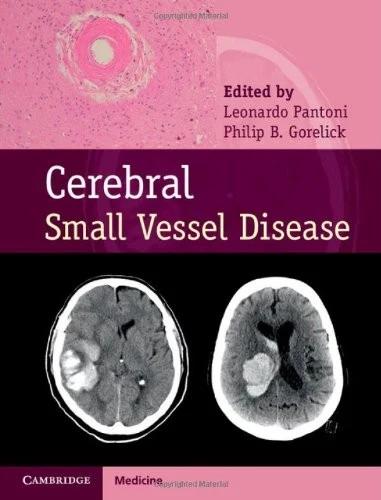 Cerebral Small Vessel Disease (English, Leonardo Pantoni | Philip B. Gorelick)