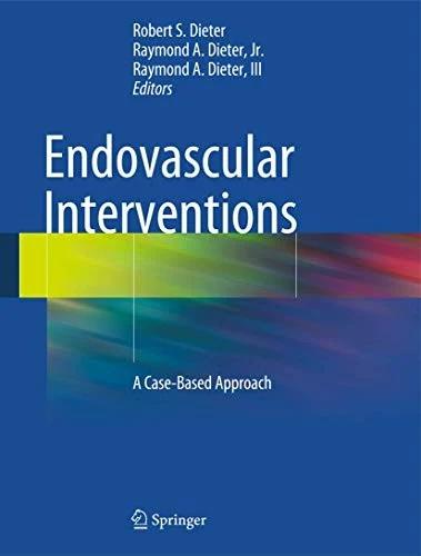 Endovascular Interventions (English, Robert S. Dieter | Raymond A. Dieter Jr | Raymond A. Dieter III)