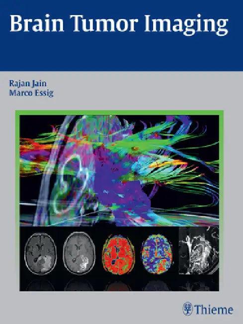 Brain Tumor Imaging (English, Rajan Jain | Marco Essig)