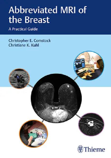 Abbreviated MRI of the Breast (English, Christopher E. Comstock | Christiane Kuhl)