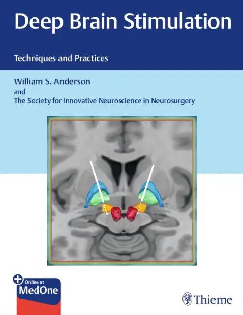 Deep Brain Stimulation (English, William S. Anderson | The Society for Innovative Neuroscience)