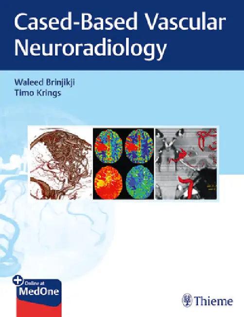 Imaging in Neurovascular Disease (English, Waleed Brinjikji | Timo Krings)