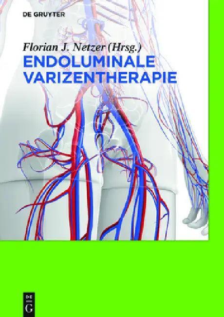 Endoluminale Varizentherapie (English, Florian Johannes Netzer)