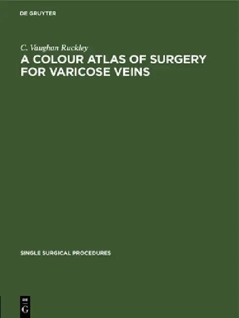 A Colour Atlas of Surgery for Varicose Veins (English, C. Vaughan Ruckley)