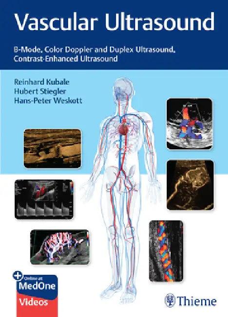 Vascular Ultrasound (English, Reinhard Kubale | Hubert Stiegler | Hans-Peter Weskott)