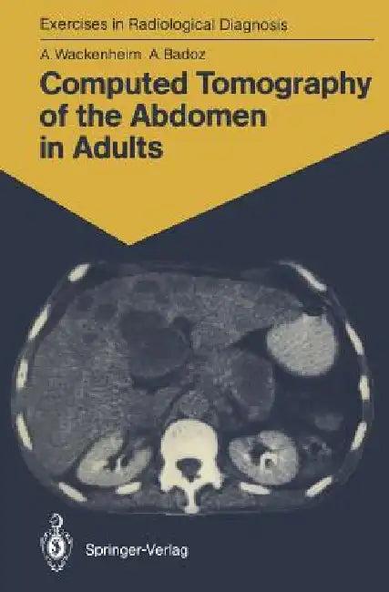 Computed Tomography of the Abdomen in Adults (English, Auguste Wackenheim | M. -T Wackenheim | Armelle Badoz)