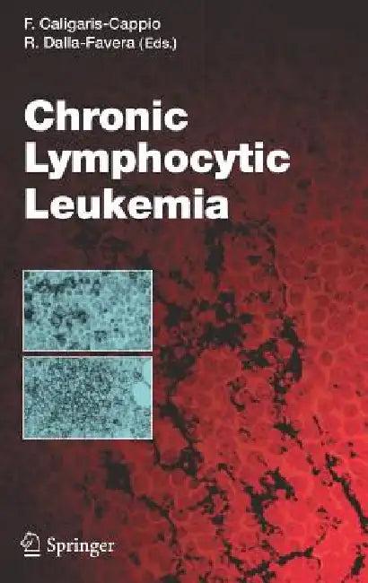 Chronic Lymphocytic Leukemia (English, Federico Caligaris-Cappio | Riccardo Dalla Favera)