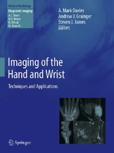 Imaging of the Hand and Wrist (English, A. Mark Davies | Andrew J. Grainger | Steven J. James)