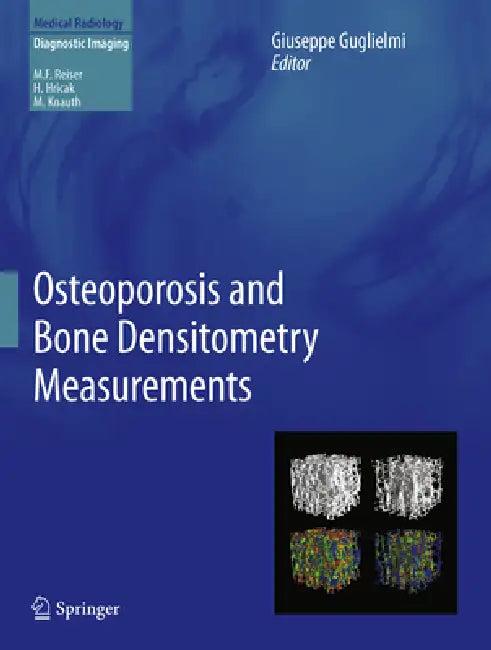 Osteoporosis and Bone Densitometry Measurements (English, Giuseppe Guglielmi)