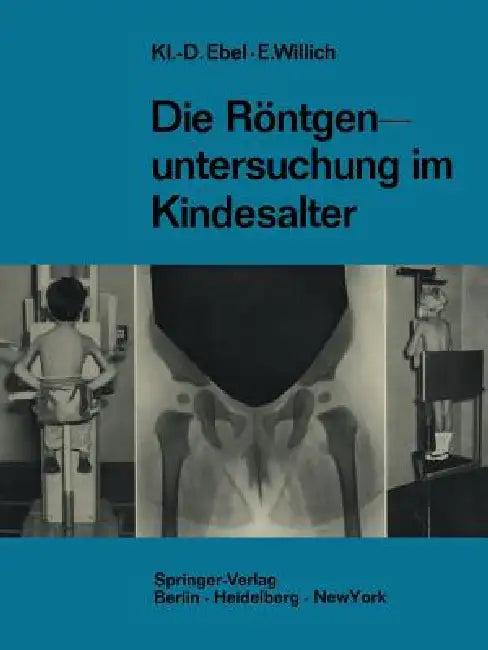 Die Röntgenuntersuchung Im Kindesalter (English, Klaus-Dietrich Ebel | Eberhard Willich)