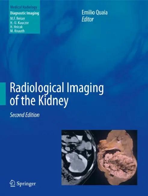 Radiological Imaging of the Kidney (English, Emilio Quaia)