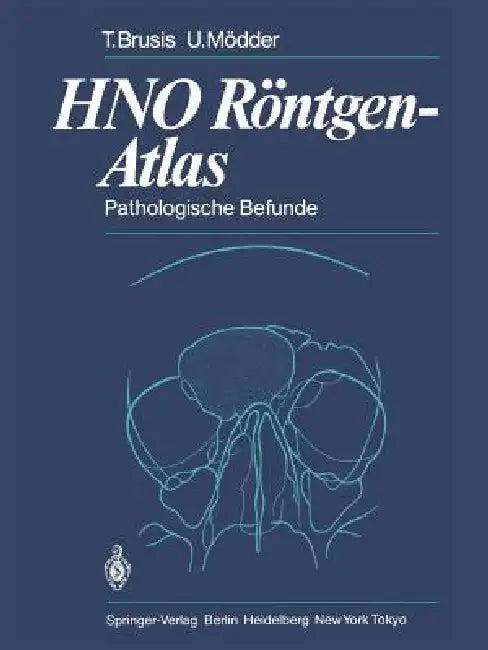Hno Röntgen-Atlas (English, Tilman Brusis | G. Friedmann | Ulrich Mödder)