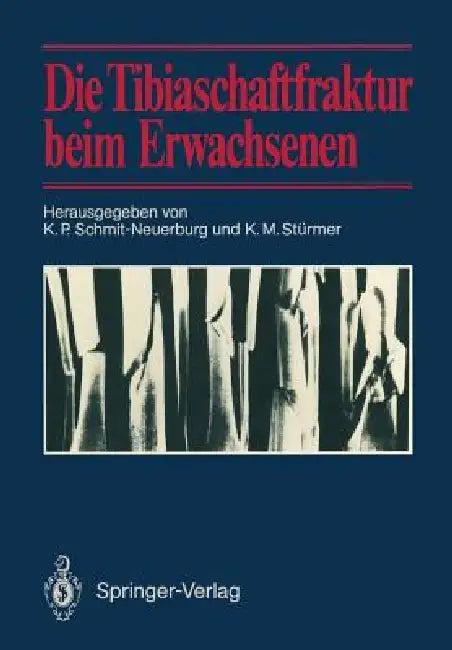 Die Tibiaschaftfraktur Beim Erwachsenen (English, K. P. Schmit-Neuerburg | K. M. Stürmer)