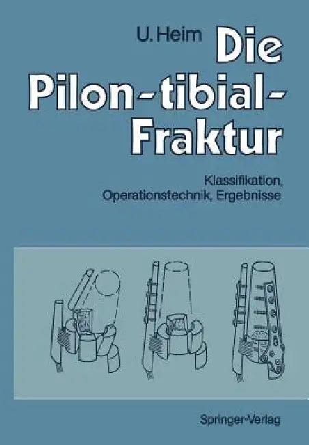 Die Pilon-Tibial-Fraktur (English, A. Gächter | Urs Heim | M. Allgöwer)
