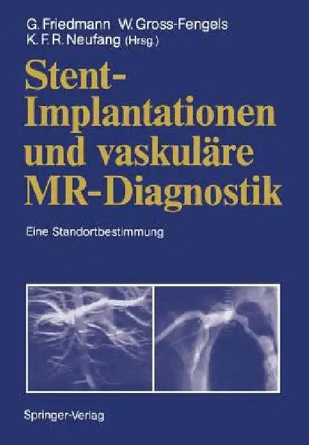Stent-Implantationen Und Vaskuläre Mr-Diagnostik (English, Gerd Friedmann | J. Bunke | Walter Gross-Fengels)
