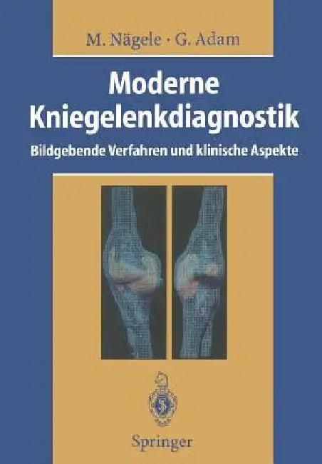 Moderne Kniegelenkdiagnostik (English, Matthias Nägele | R. W. Günther | Gerhard Adam)