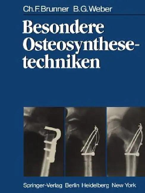 Besondere Osteosynthesetechniken (English, C. F. Brunner | B. G. Weber)