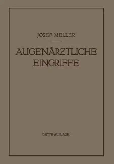 Augenärztliche Eingriffe (English, Josef Meller)