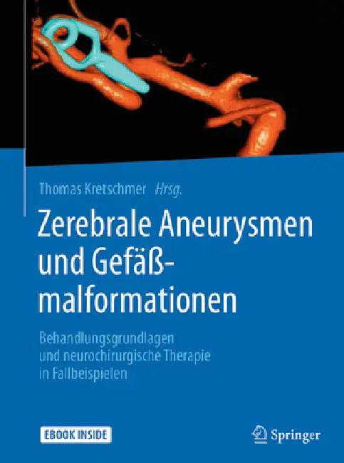Zerebrale Aneurysmen Und Gefäßmalformationen (English, Thomas Kretschmer)