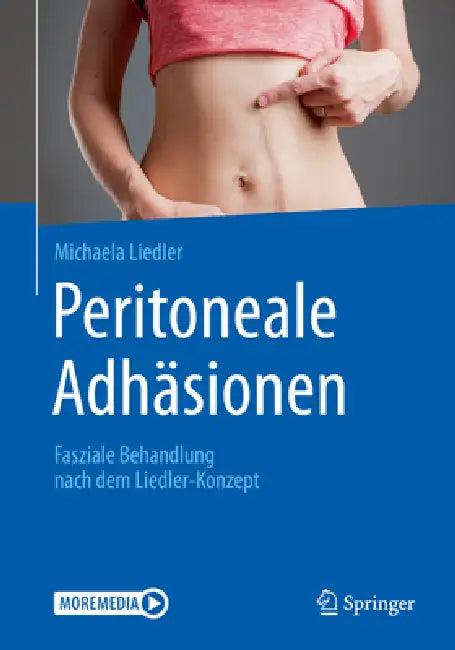 Peritoneale Adhäsionen (English, Michaela Liedler)