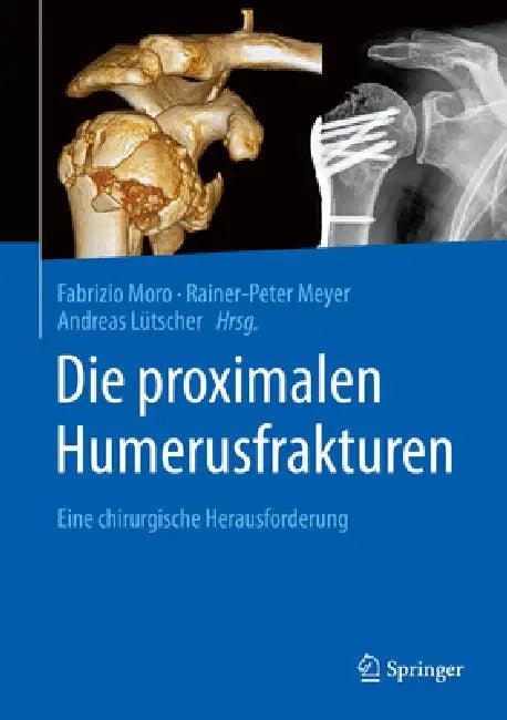 Die Proximalen Humerusfrakturen (English, Fabrizio Moro | Rainer-Peter Meyer | Andreas Lütscher)