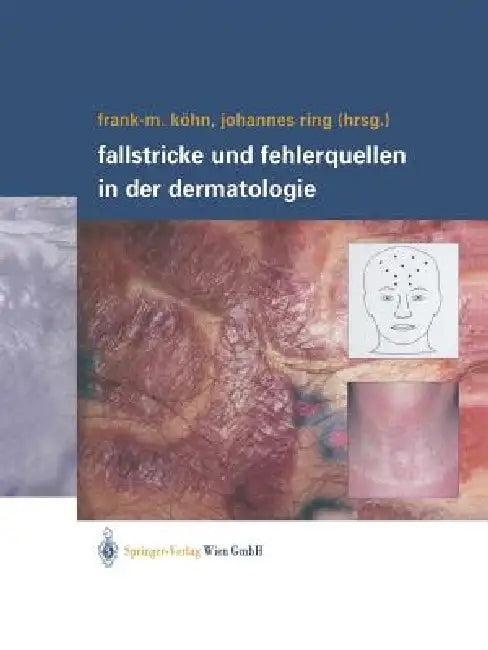 Fallstricke Und Fehlerquellen in Der Dermatologie (English, Frank-Michael Köhn | Johannes Ring)