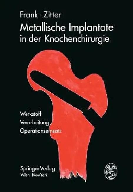 Metallische Implantate in Der Knochenchirurgie (English, Erich Frank | Herbert Zitter)