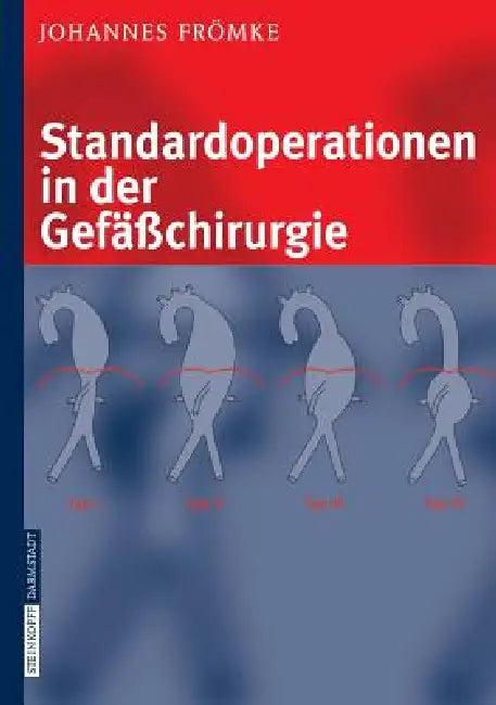 Standardoperationen in Der Gefäßchirurgie (English, Johannes Frömke)