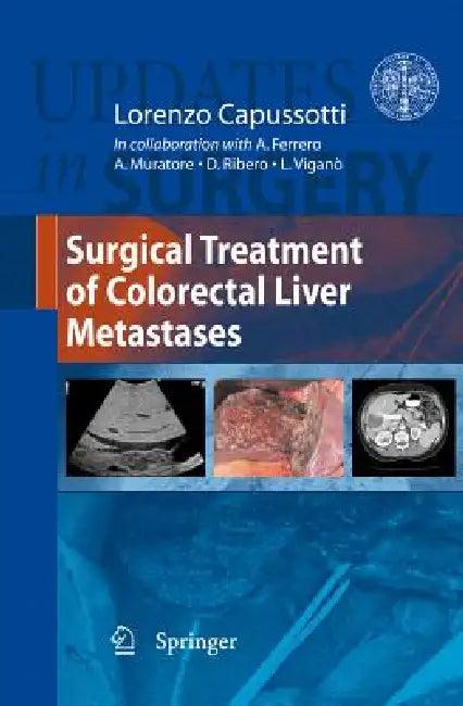 Surgical Treatment of Colorectal Liver Metastases (English, Lorenzo Capussotti)