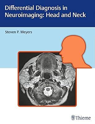Differential Diagnosis in Neuroimaging: Head and Neck by Meyers | Hardcover | Radiology