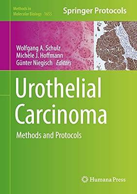 Urothelial Carcinoma: Methods and Protocols: 1655 (Methods in Molecular Biology) | Hardcover | Oncology
