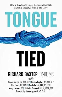 Tongue-Tied: How a Tiny String Under the Tongue Impacts Nursing, Speech, Feeding, and More by Baxter, MS DMD Richard | Paperback | Medical