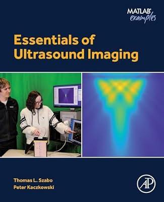 Essentials of Ultrasound Imaging (Matlab Examples) by Szabo, Thomas L.; Kaczkowski, Peter | Paperback | Ultrasonics