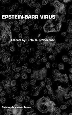 Epstein-Barr Virus | Hardcover | Medical Microbiology & Virology